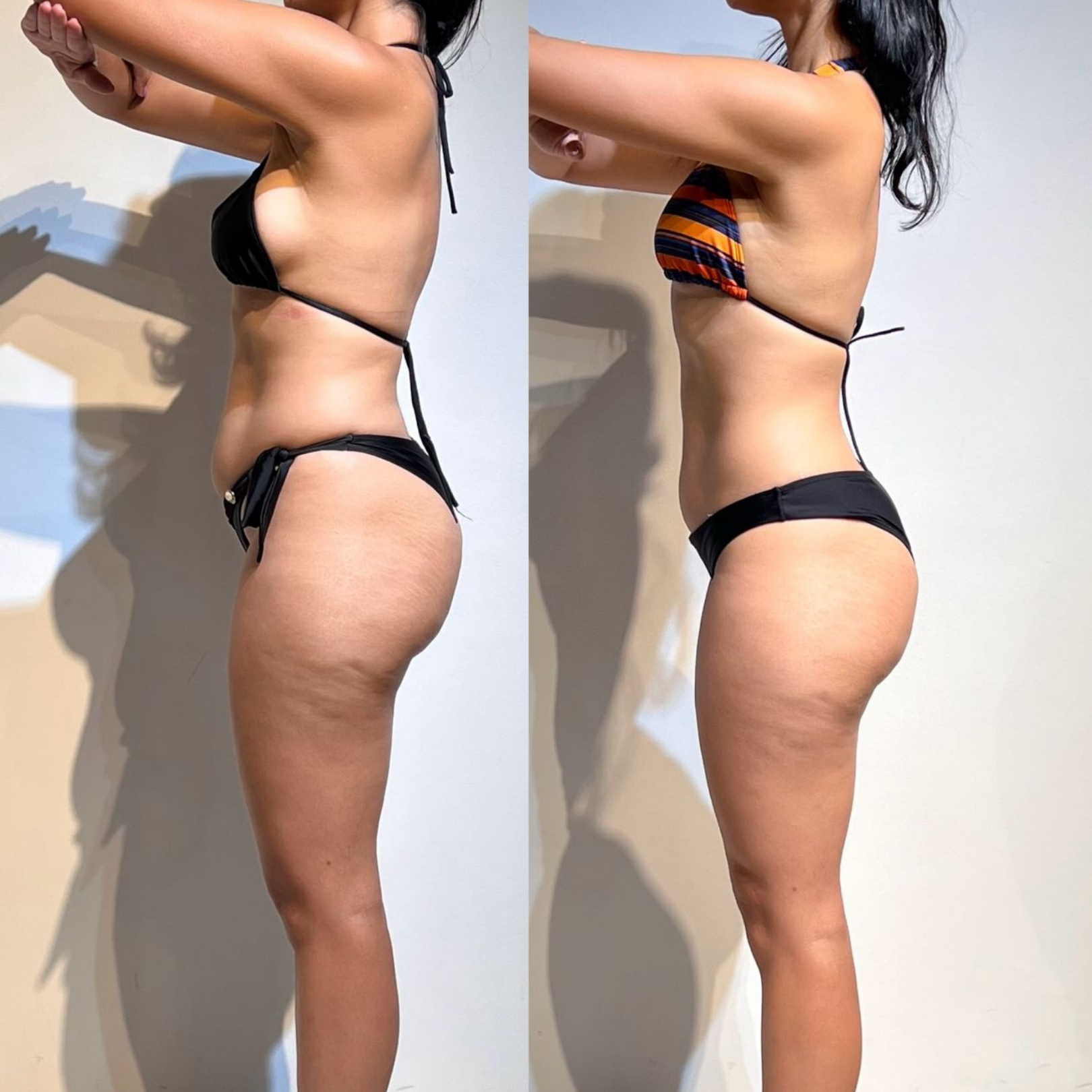 essa tirou a barriga fora em apenas alguns dias e semanas que se tornaram meses